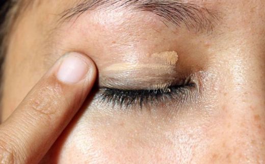 Göz Kapağında Yağ Bezesi Belirtileri ve Tedavisi